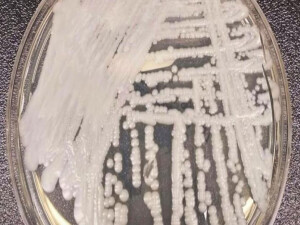 Katil mantar, dünya genelinde yayılıyor