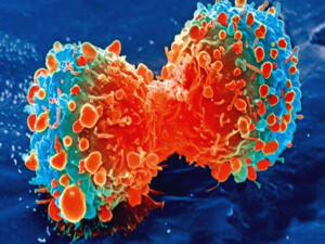 "Sessiz katil"e karşı yeni umut: Mekanizma bozulunca tümörler küçüldü