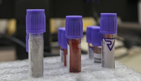 İngiltere’de 55 bin kişi, hatalı diyabet testleri yüzünden yeniden kan verecek