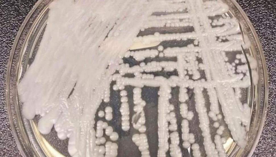 Katil mantar, dünya genelinde yayılıyor