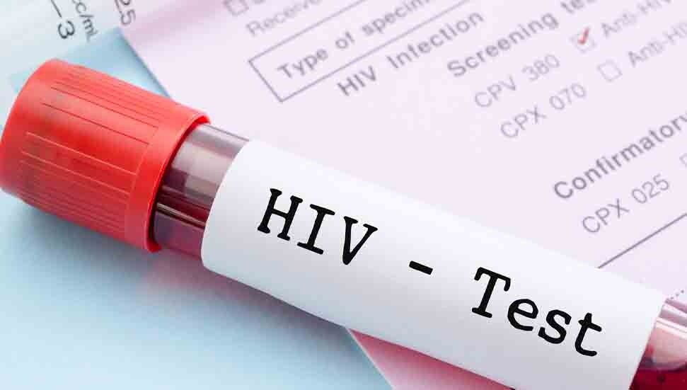 DSÖ, 2024'te 1,3 milyon kişinin AIDS hastalığına yakalandığını bildirdi