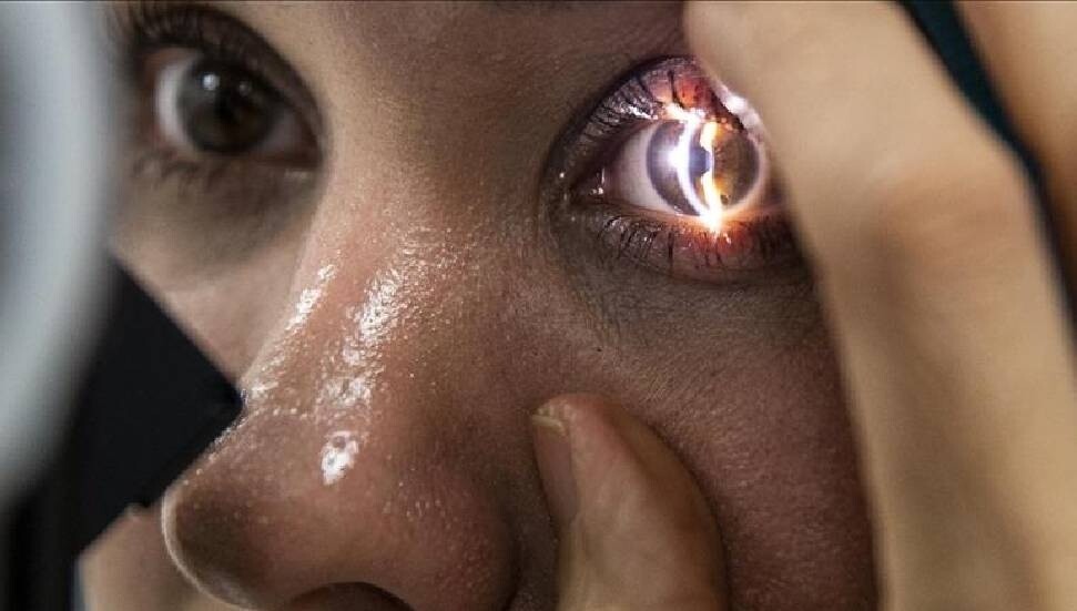 Yapay zekaya güvenilerek ihmal edilen göz sağlığı tedaviyi zorlaştırıyor